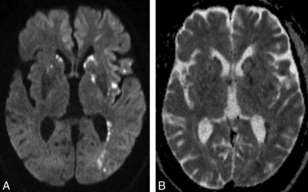 Fig 3.
