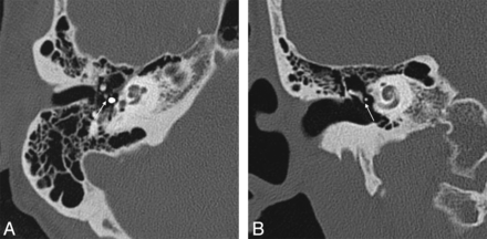 Fig 3.