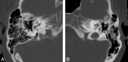 Fig 8.