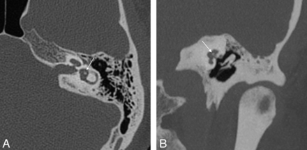 Fig 9.