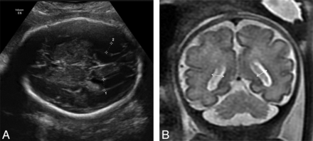 Fig 2.