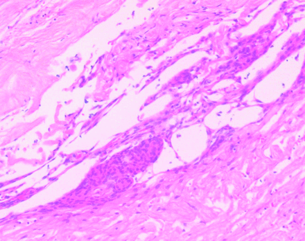 Fig 4.