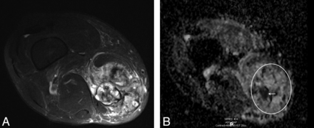 Fig 4.