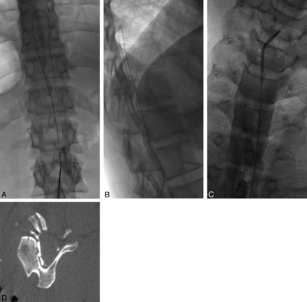 Fig 2.