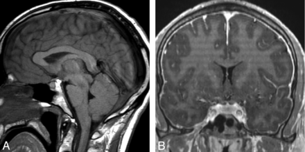 Fig 3.