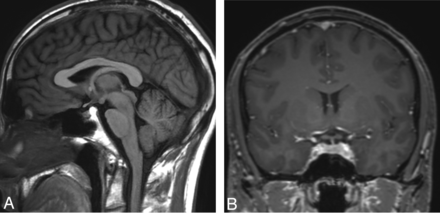 Fig 4.
