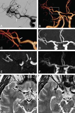 Fig 1.