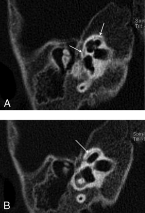 Fig 3.