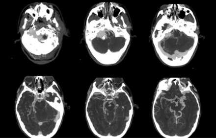 Fig 3.