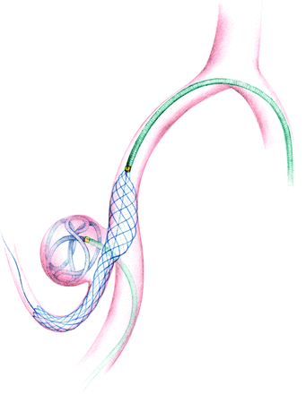 Fig 1.