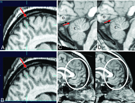 Fig 1.