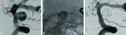 Fig 3.