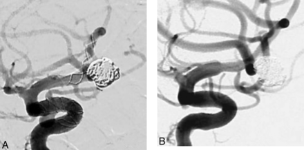 Fig 4.