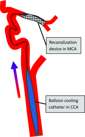 Fig 1.