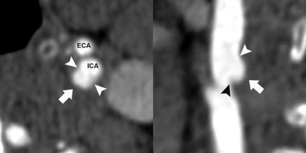 Fig 1.