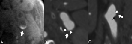 Fig 4.