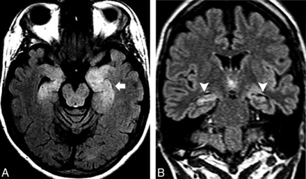 Fig 4.