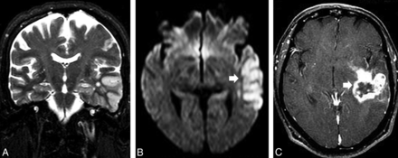 Fig 7.