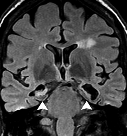 Fig 9.