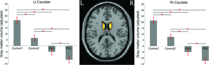 Fig 2.