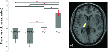 Fig 3.