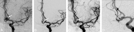Fig 2.