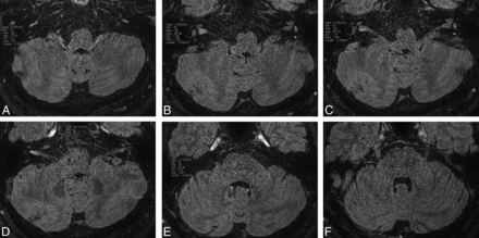 Fig 2.
