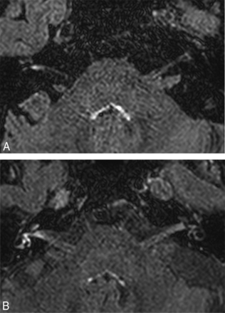 Fig 3.