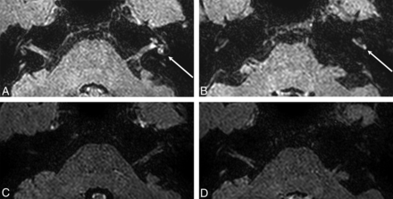 Fig 5.