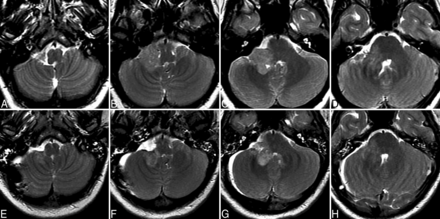 Fig 4.