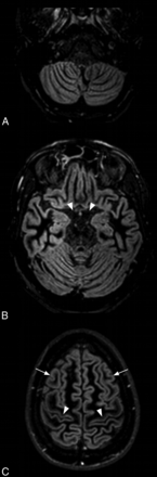 Fig 1.