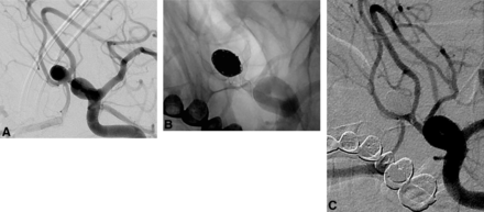 Fig 1.
