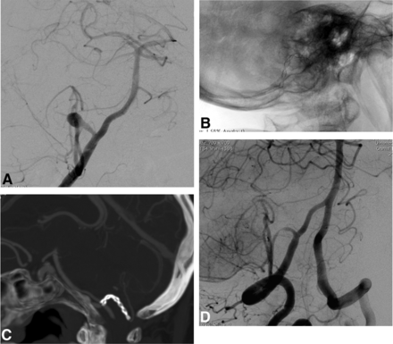 Fig 3.