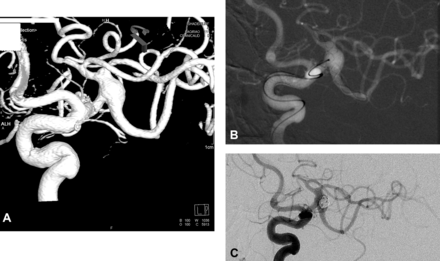 Fig 4.