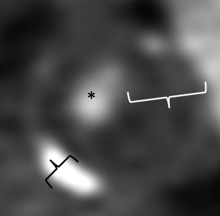 Fig 1.