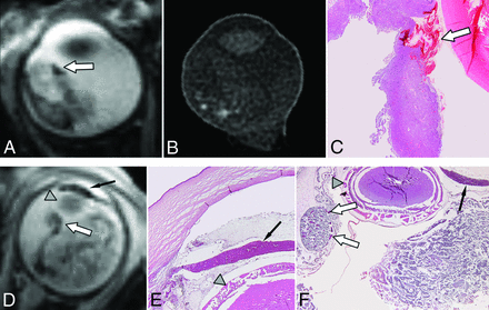Fig 2.