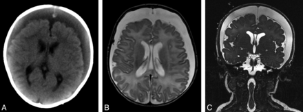Fig 1.