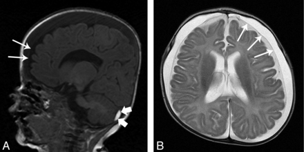 Fig 3.