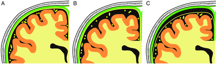 Fig 5.