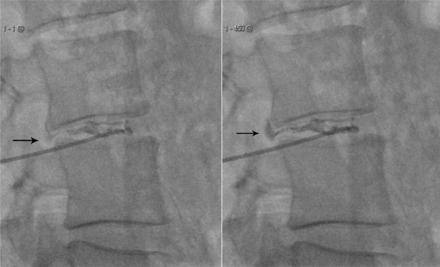 Fig 1.