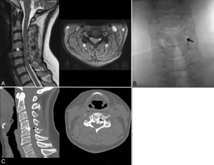 Fig 5.