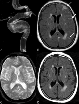 Fig 3.
