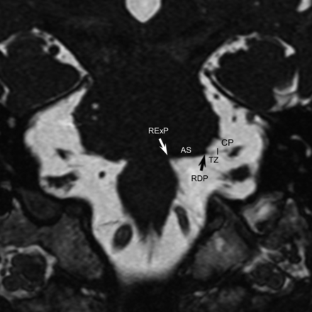 Fig 1.