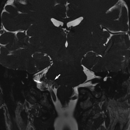 Fig 5.