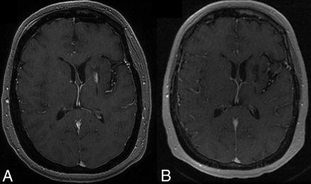 Fig 2.