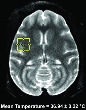 Fig 5.