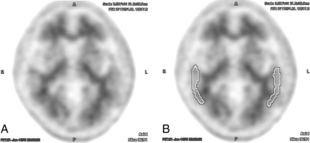 Fig 3.