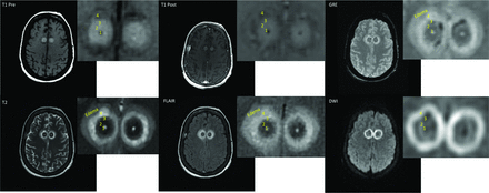 Fig 2.