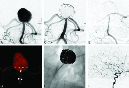 Fig 2.