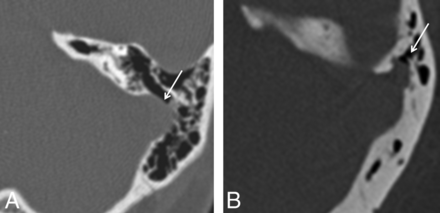 Fig 1.